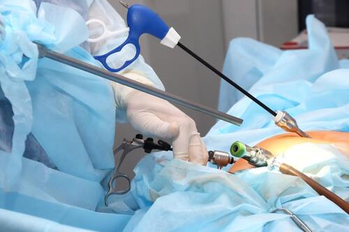 Operative Hysteroscopy