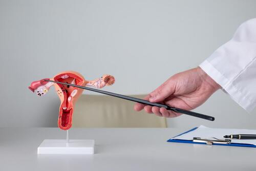 Vaginoplasty